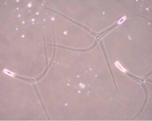 Actinospores under a microscope